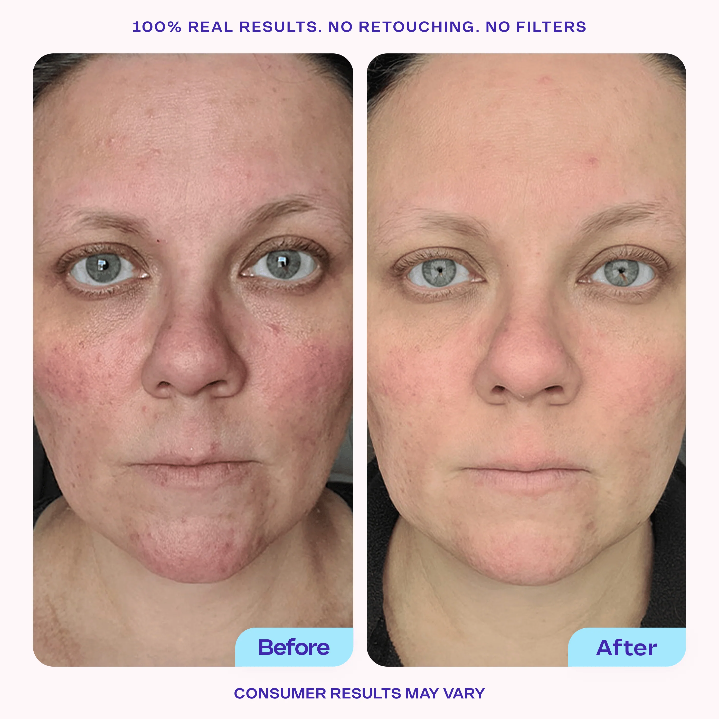 Brighten & Even Serum - Free Gift - Image 3