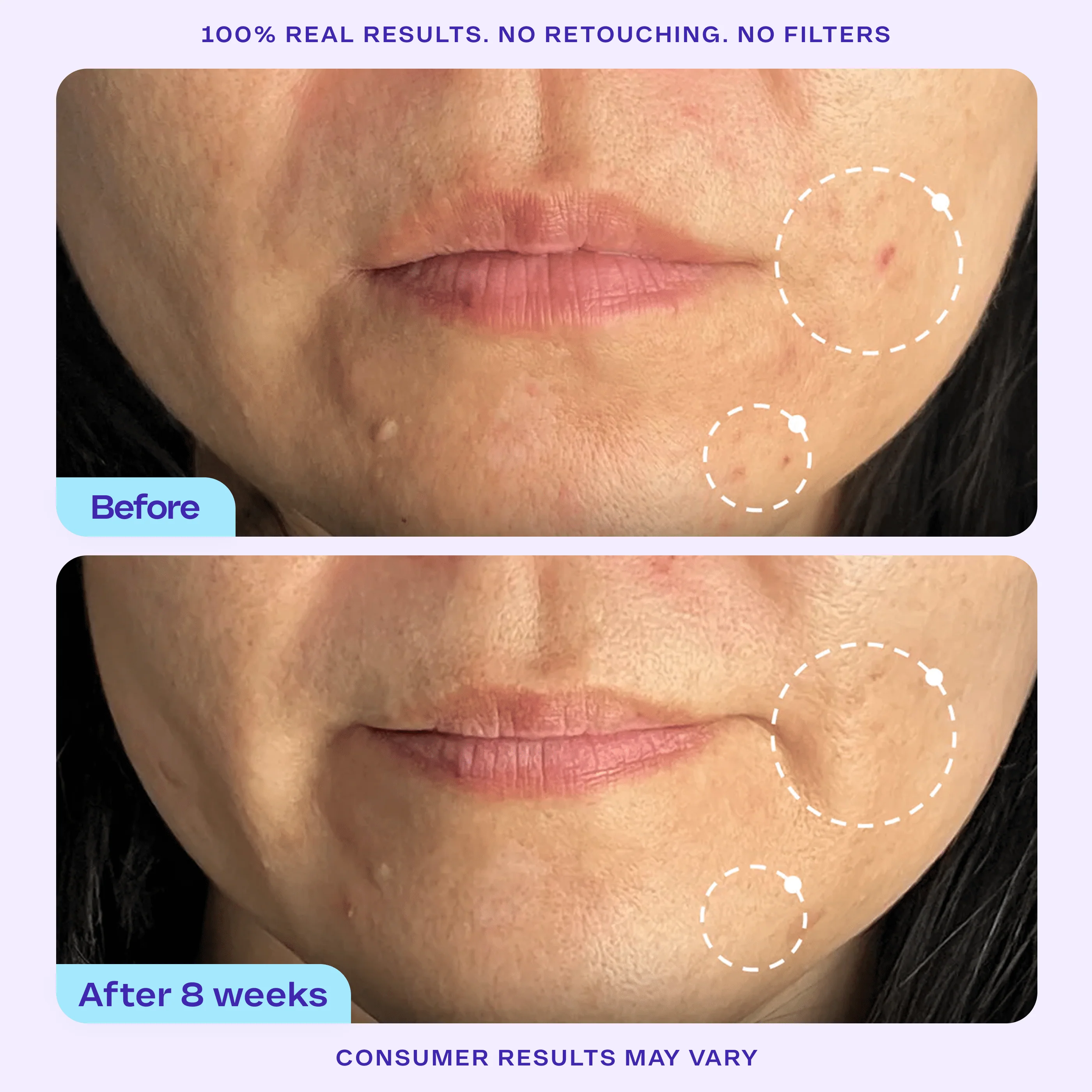 Refine It! BHA Liquid Exfoliant - Image 5