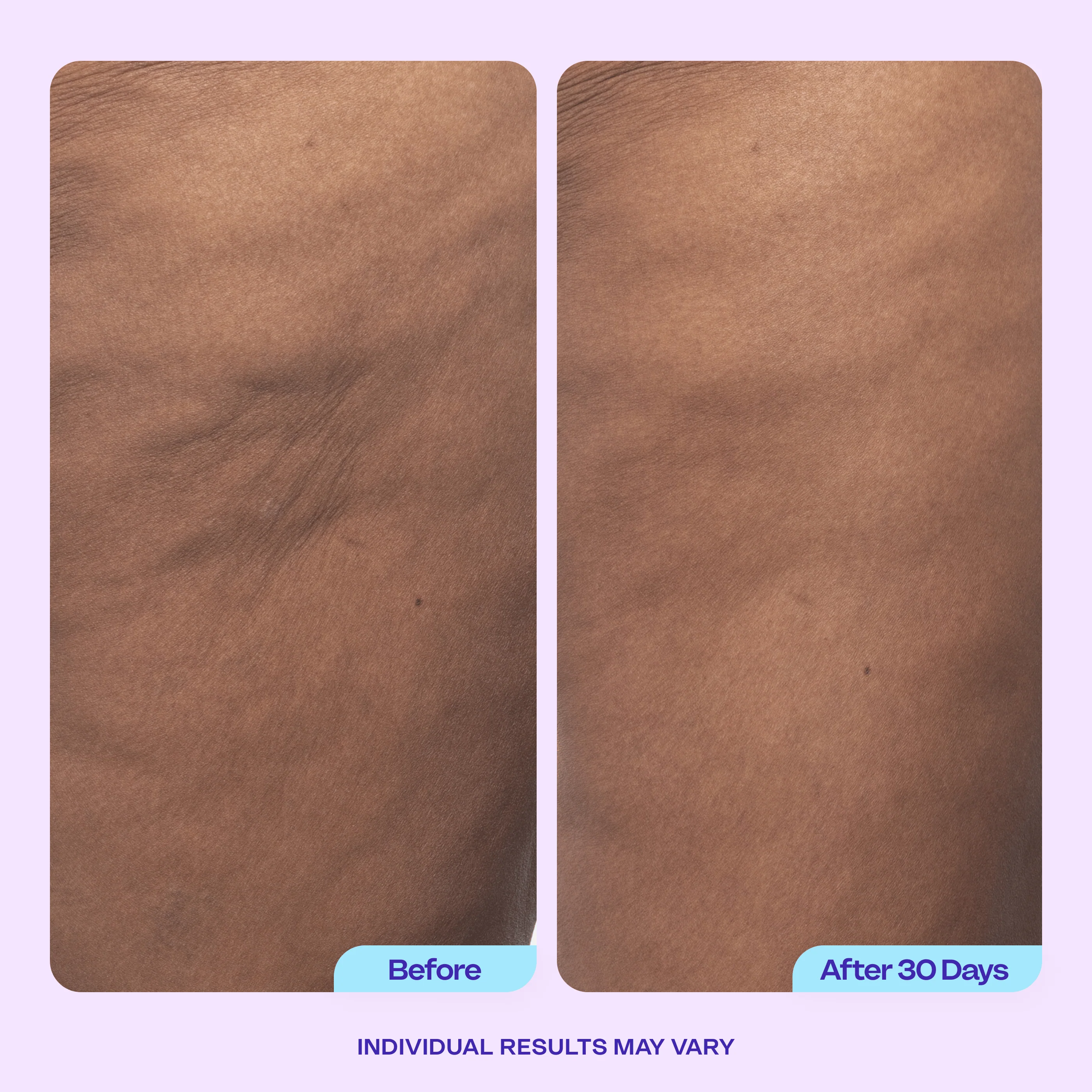 Firming Butt & Thigh Cream - Image 3