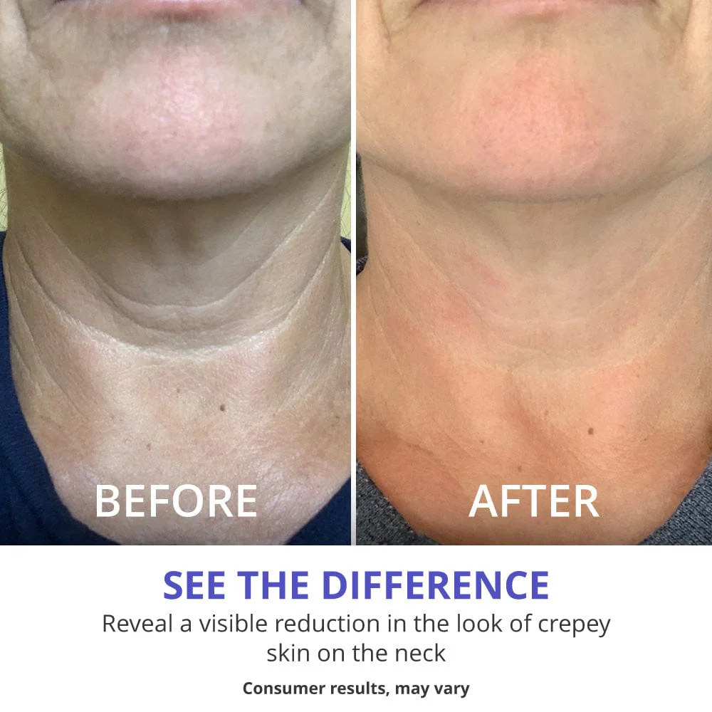 GOPURE Tighten & Lift Neck Cream - Image 5