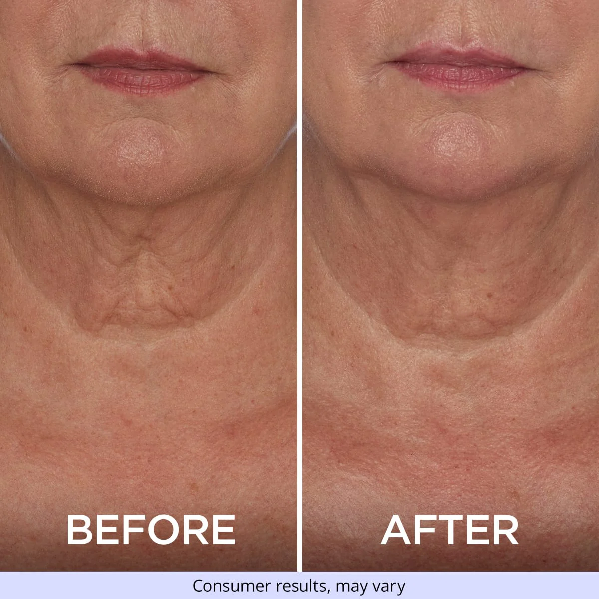 Tighten & Lift Neck Cream - Image 3