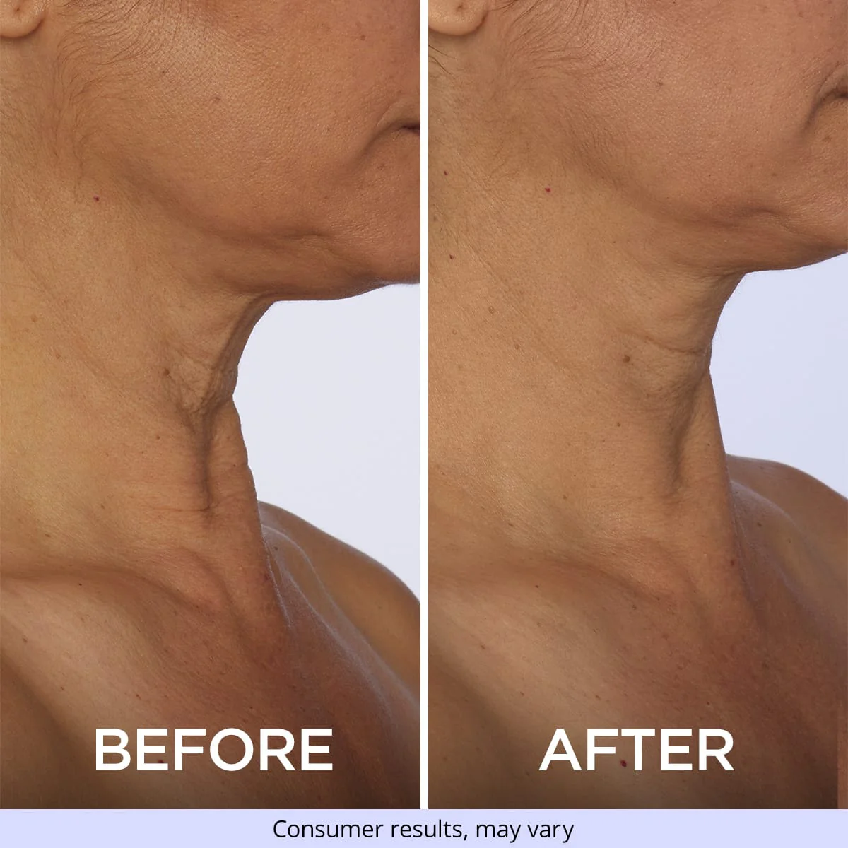 Tighten & Lift Neck Cream - Image 5