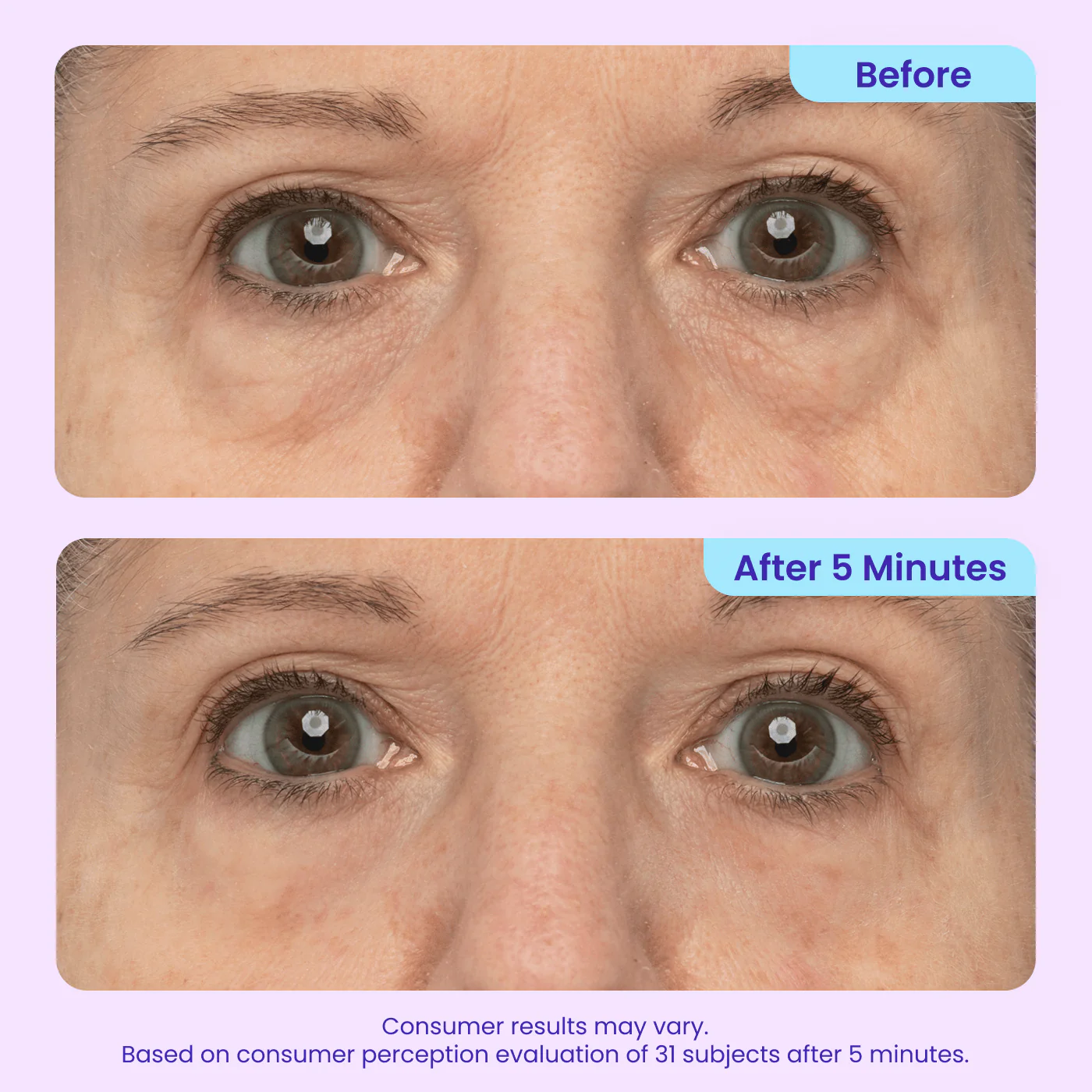 Try Before You Buy - Instant Lift Eye Gel - Image 6