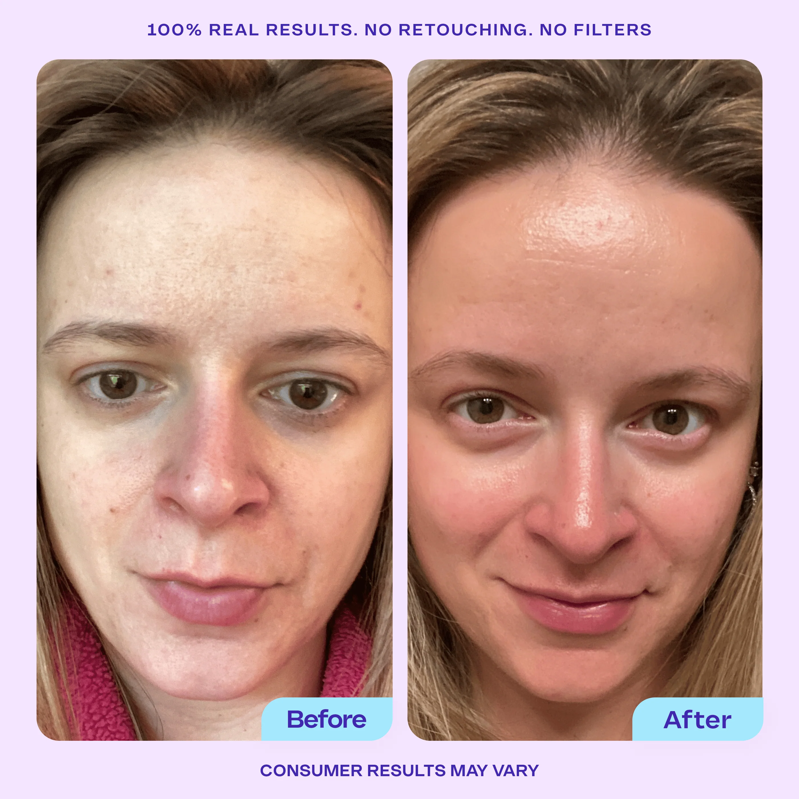 Try Before You Buy - Niacinamide Booster Serum - Image 3