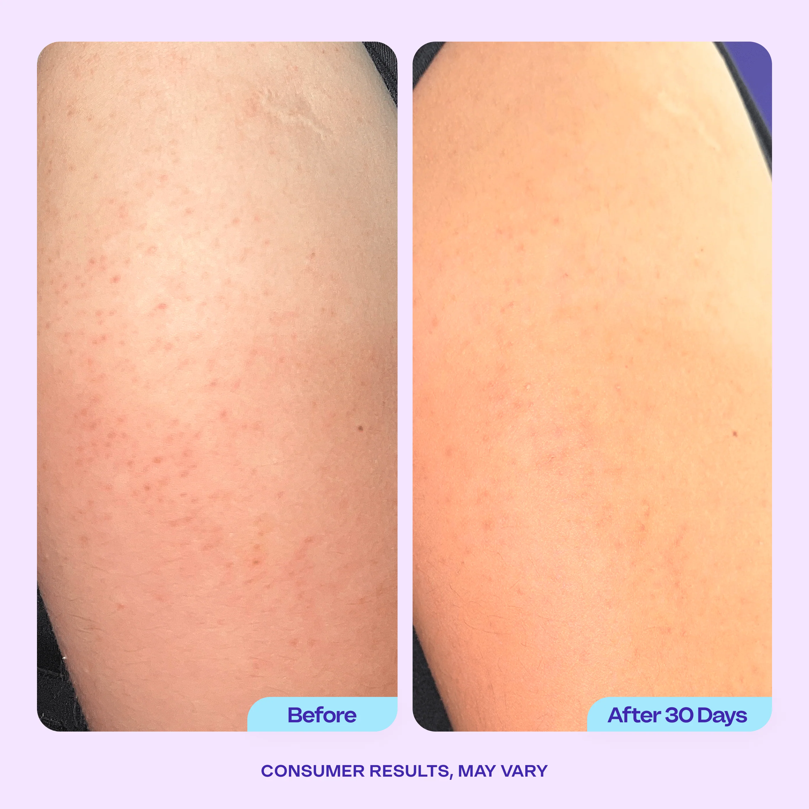 Refine & Renew Body Scrub - Free Gift - Image 3