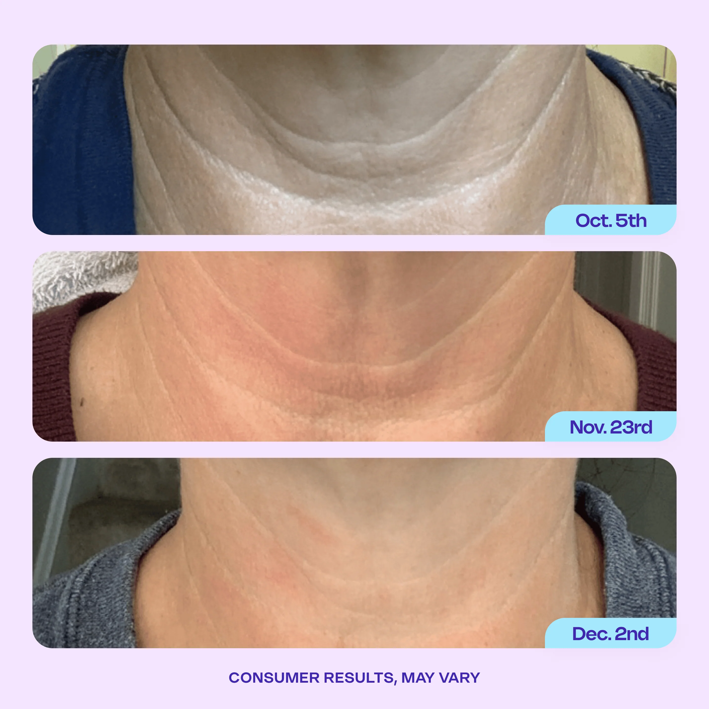 Tighten & Lift Neck Cream - 1 Jar - Image 3