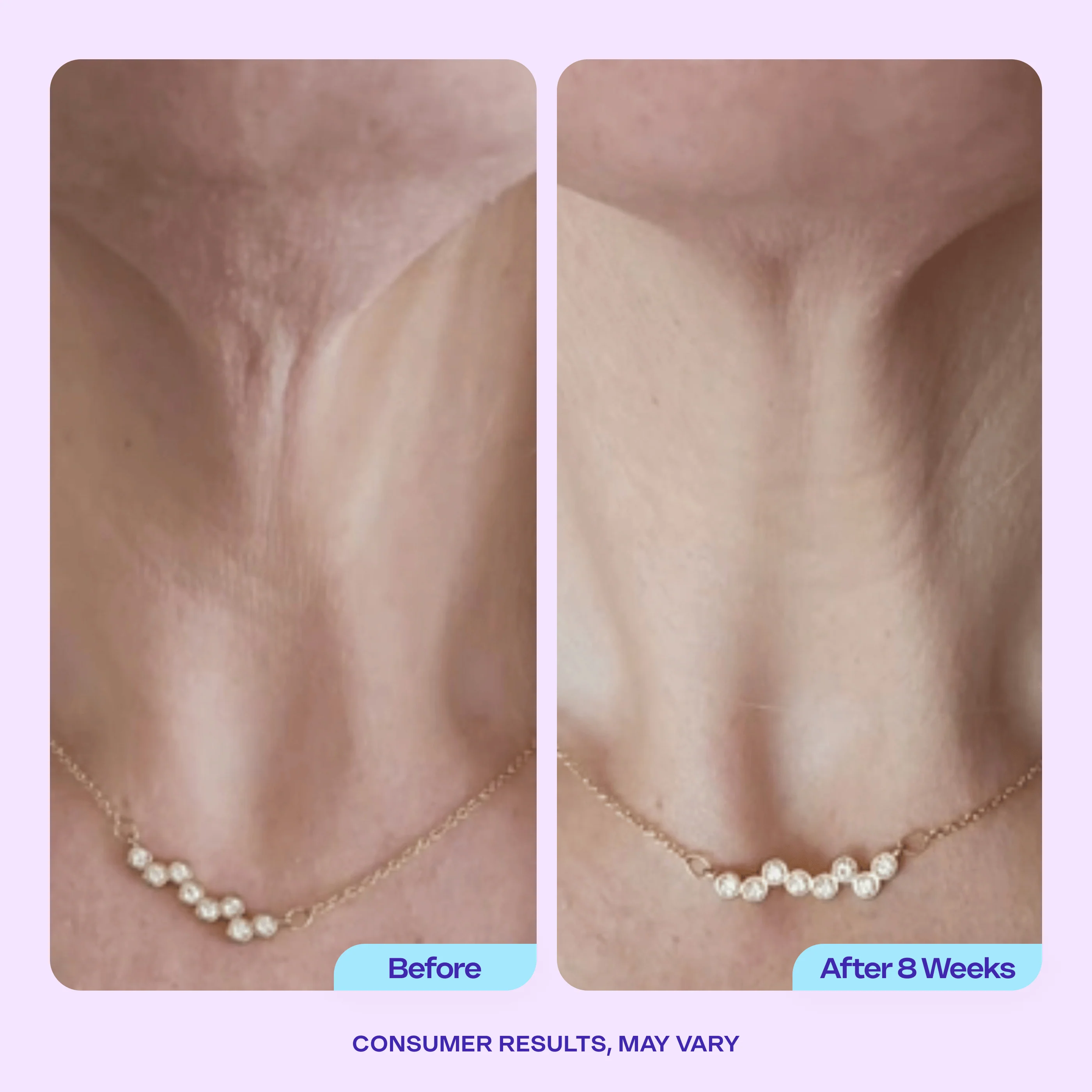 Tighten & Lift Neck Cream - 1 Jar - Image 5