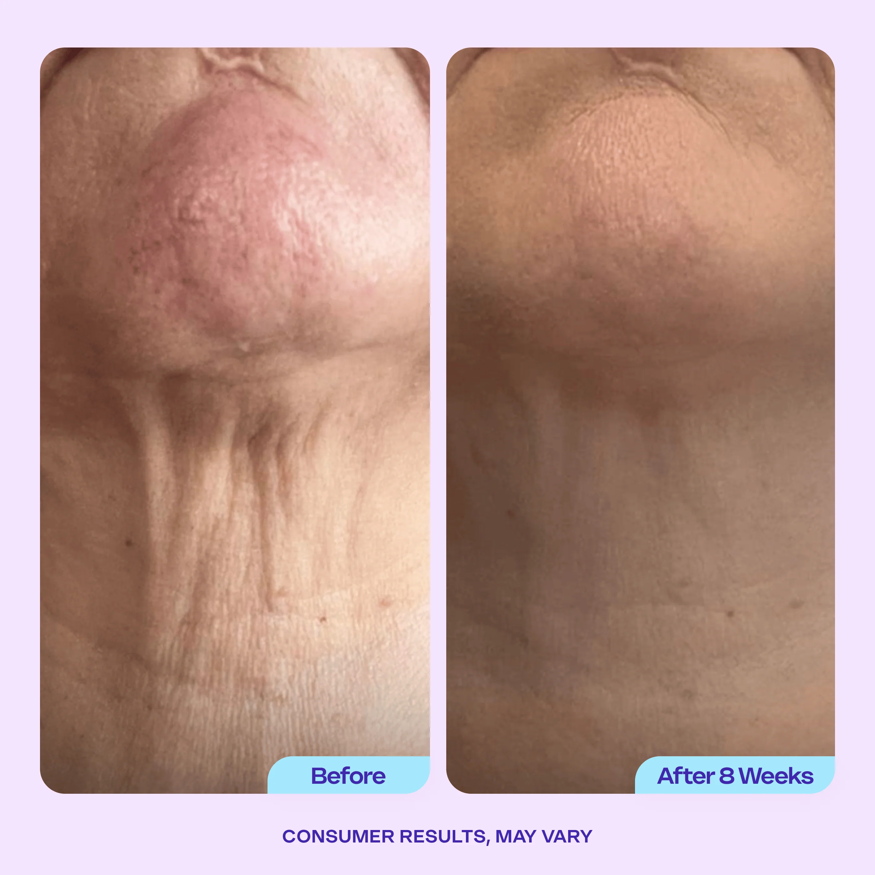 Tighten & Lift Neck Cream - 1 Jar - Image 8
