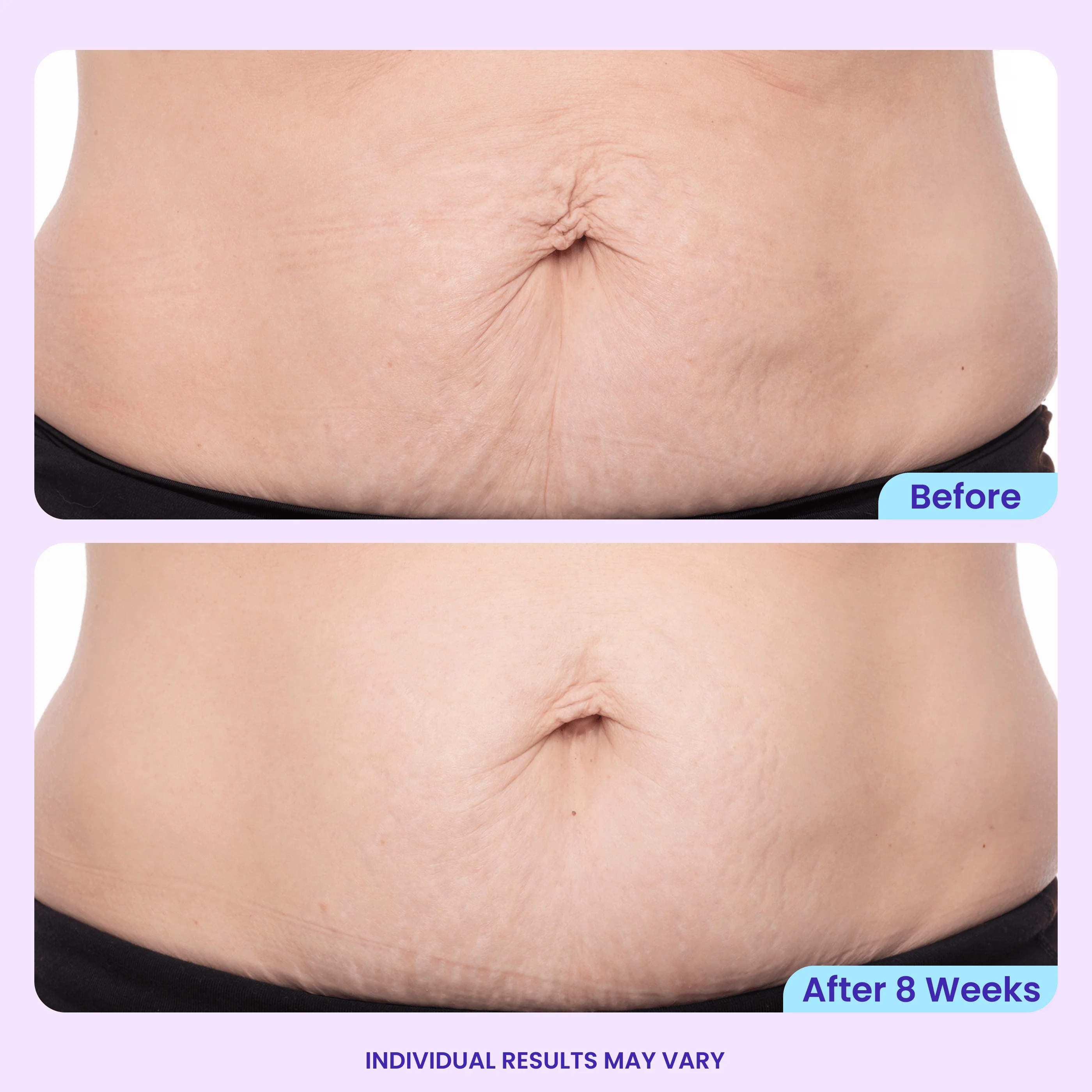 Tighten & Smooth Belly Cream - Image 3