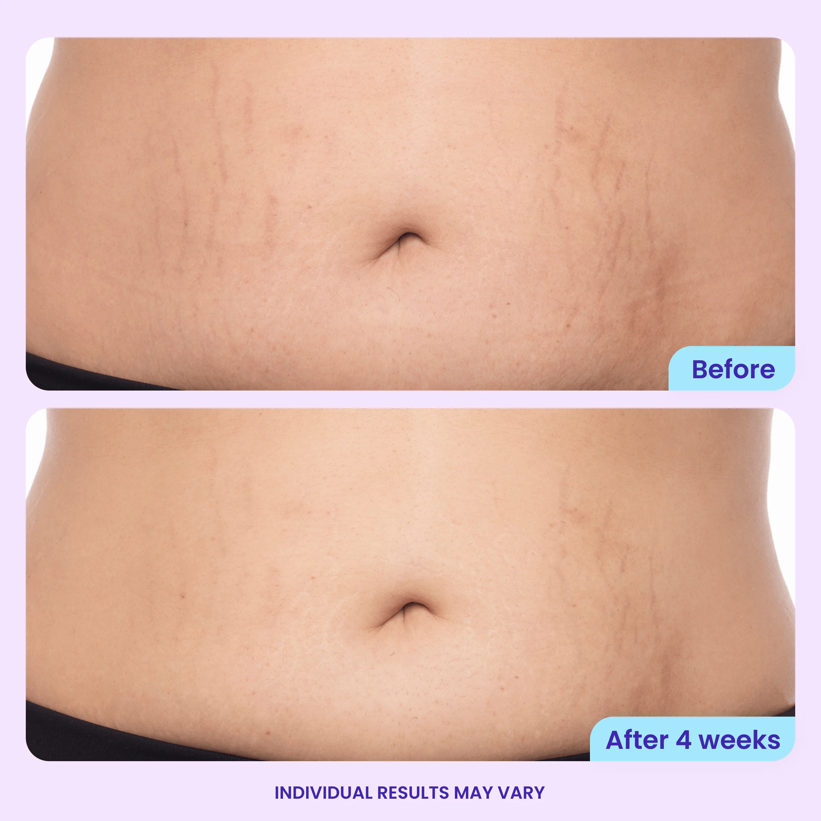 Tighten & Smooth Belly Cream - Image 6