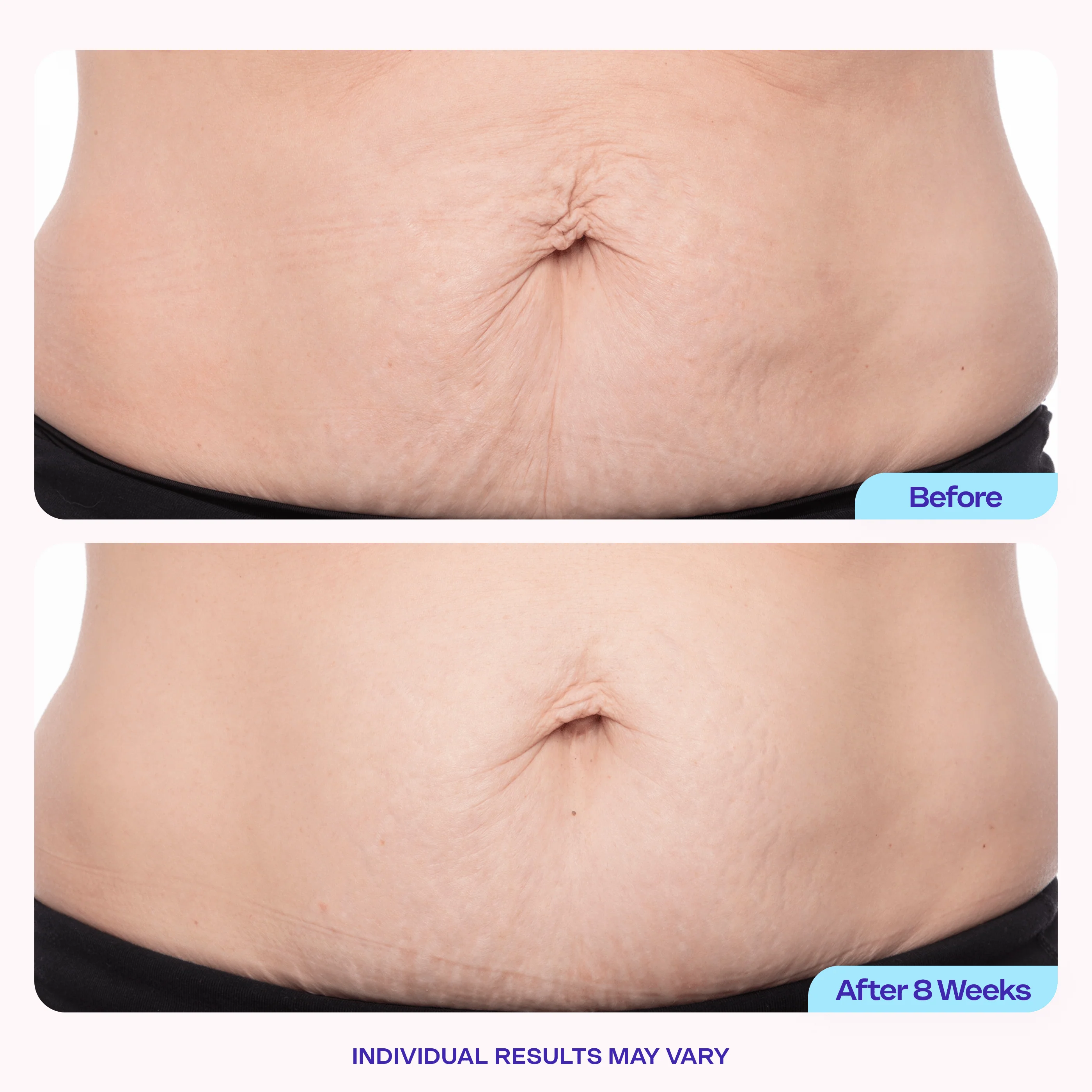 Tighten & Smooth Belly Cream - 1 Jar Webflow Compare Product - Image 3