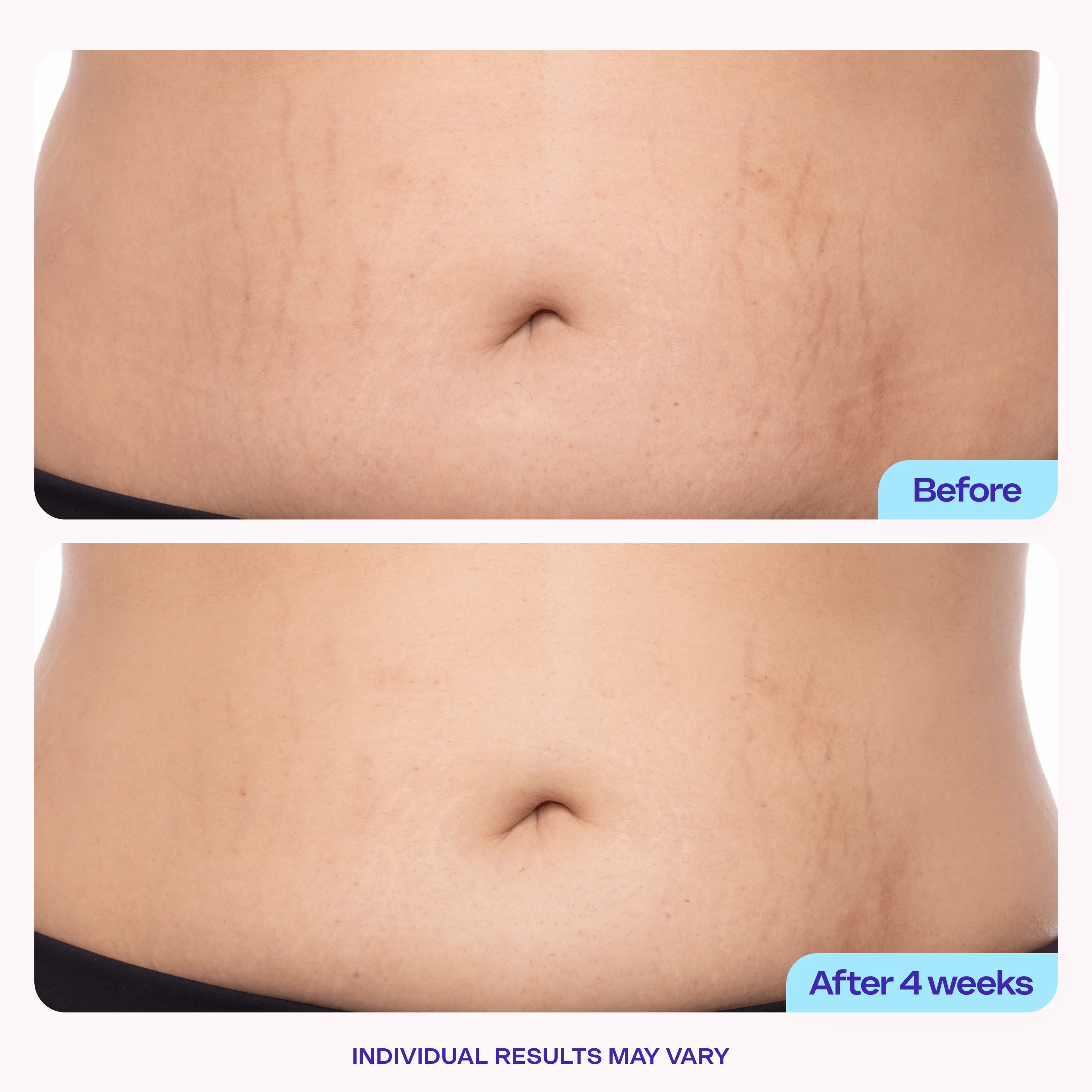 Tighten & Smooth Belly Cream - 1 Jar Webflow Compare Product - Image 6