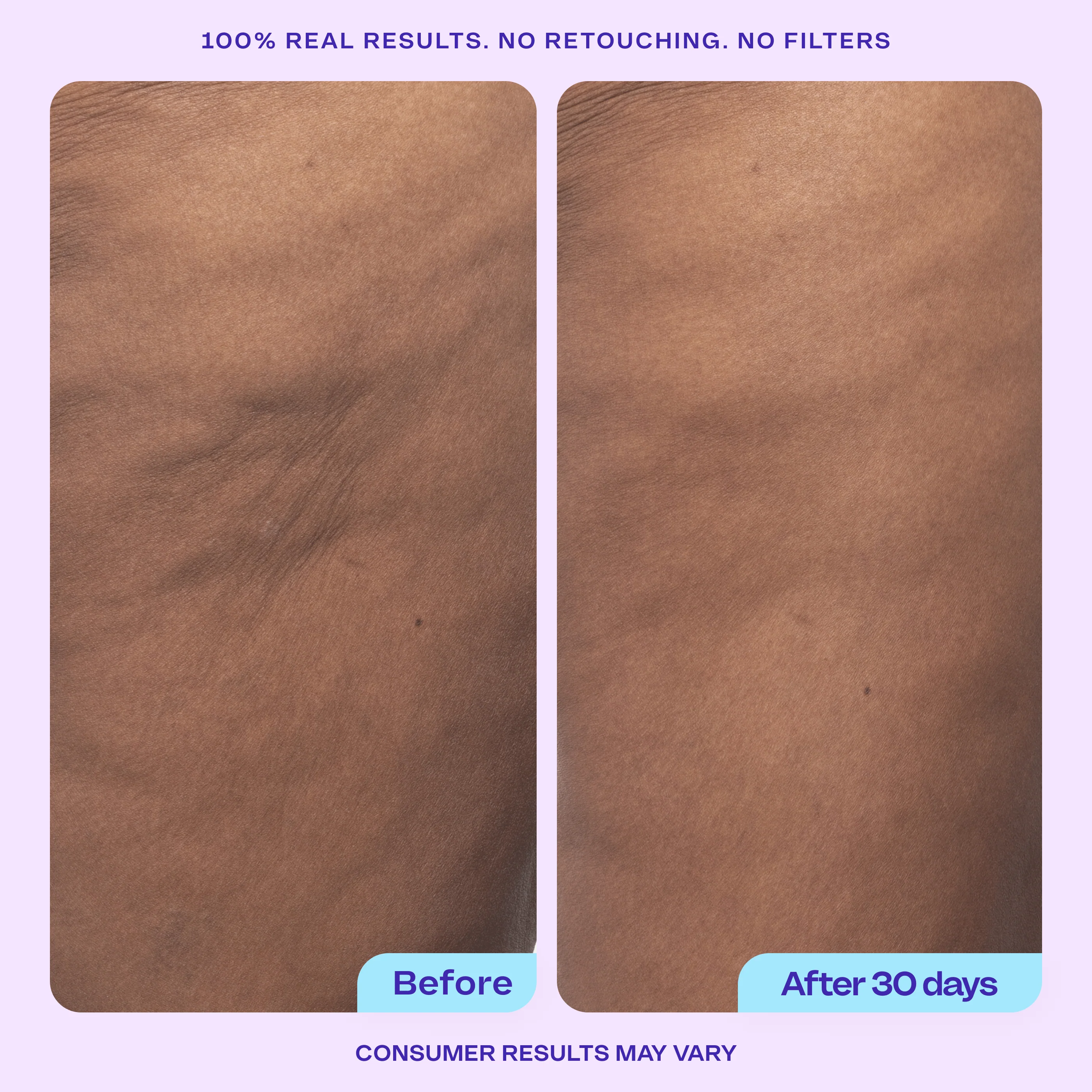 Total Body Firming Set - Image 10
