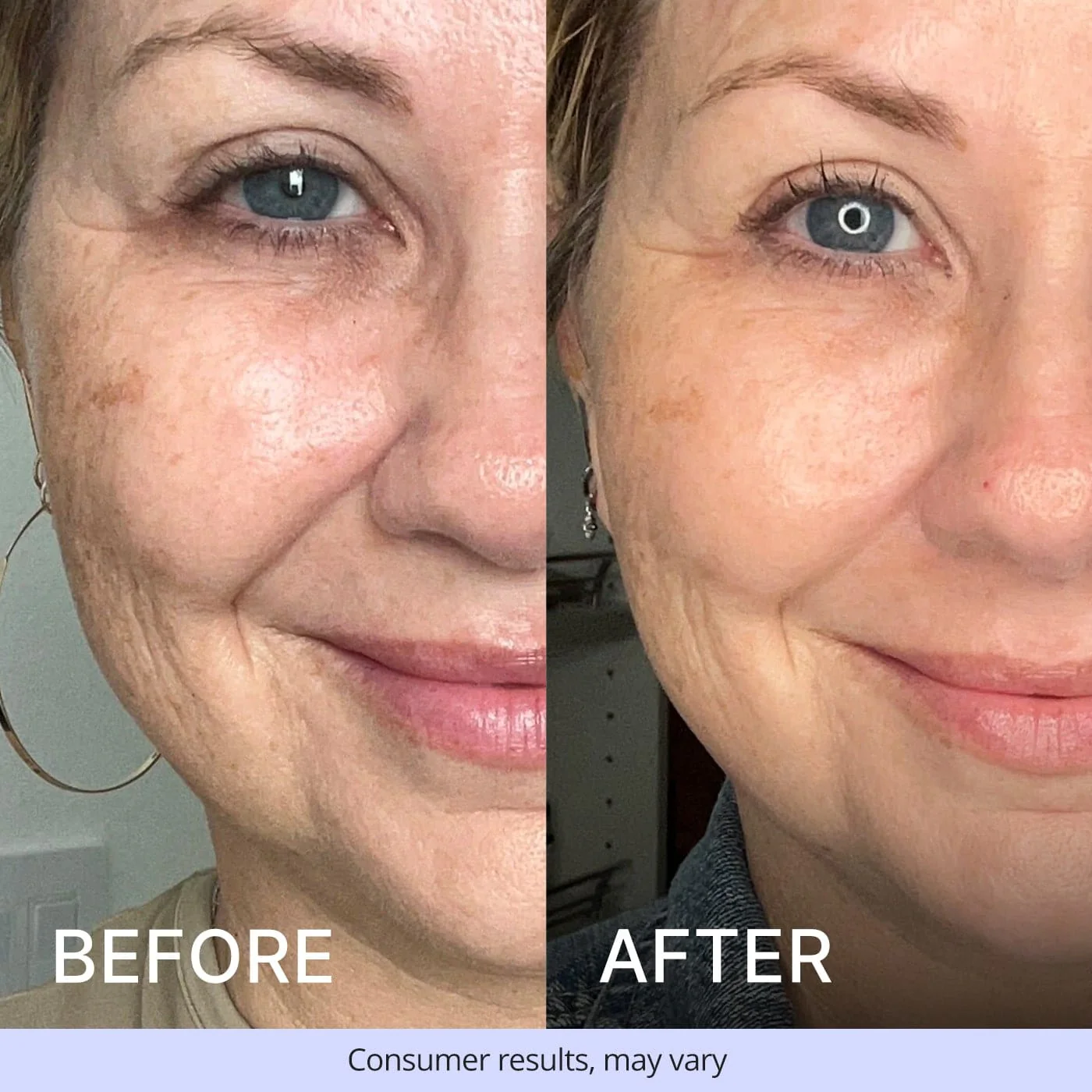 Try Before You Buy - Advanced Repair Eye Cream - Image 6