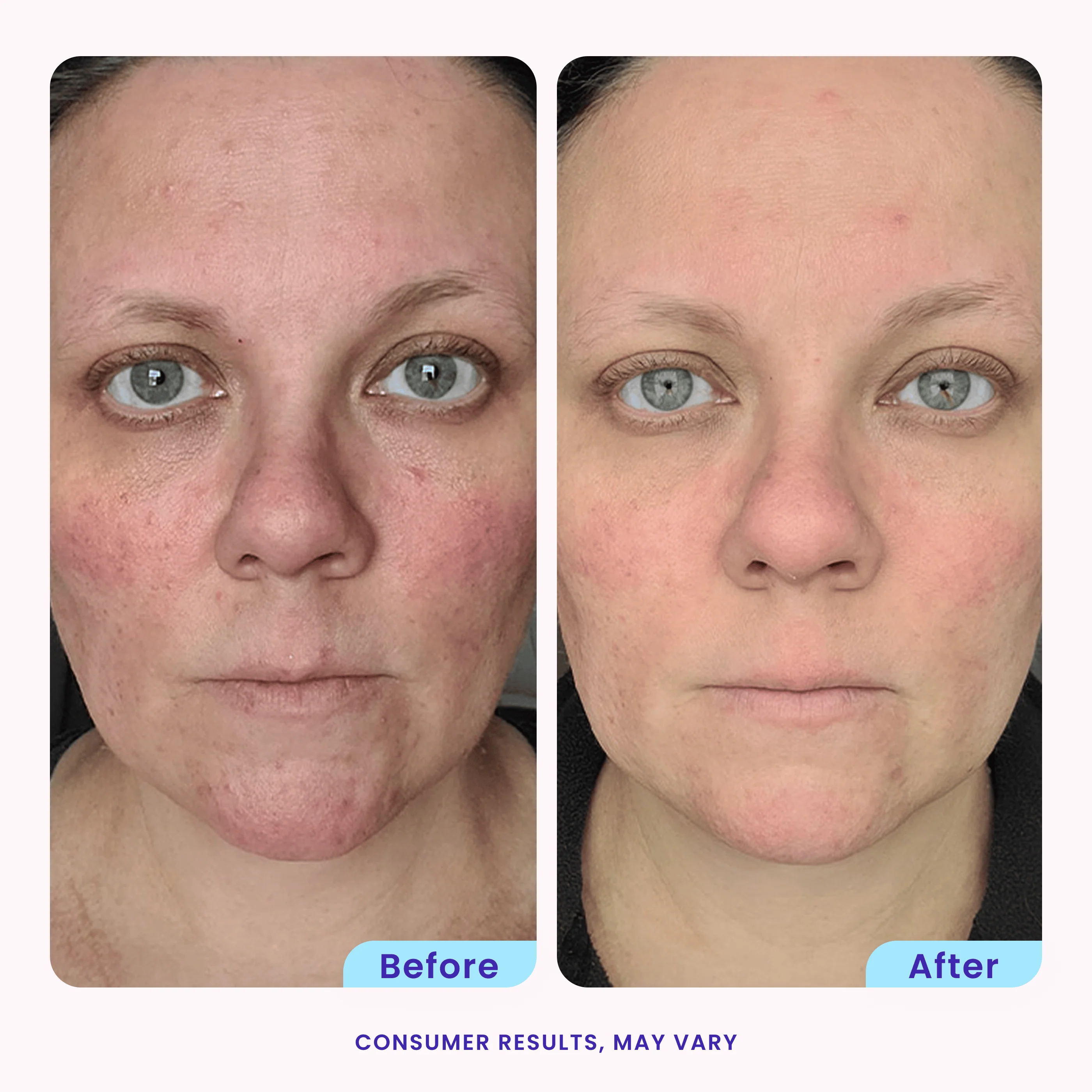 Brighten & Even Serum - Image 3
