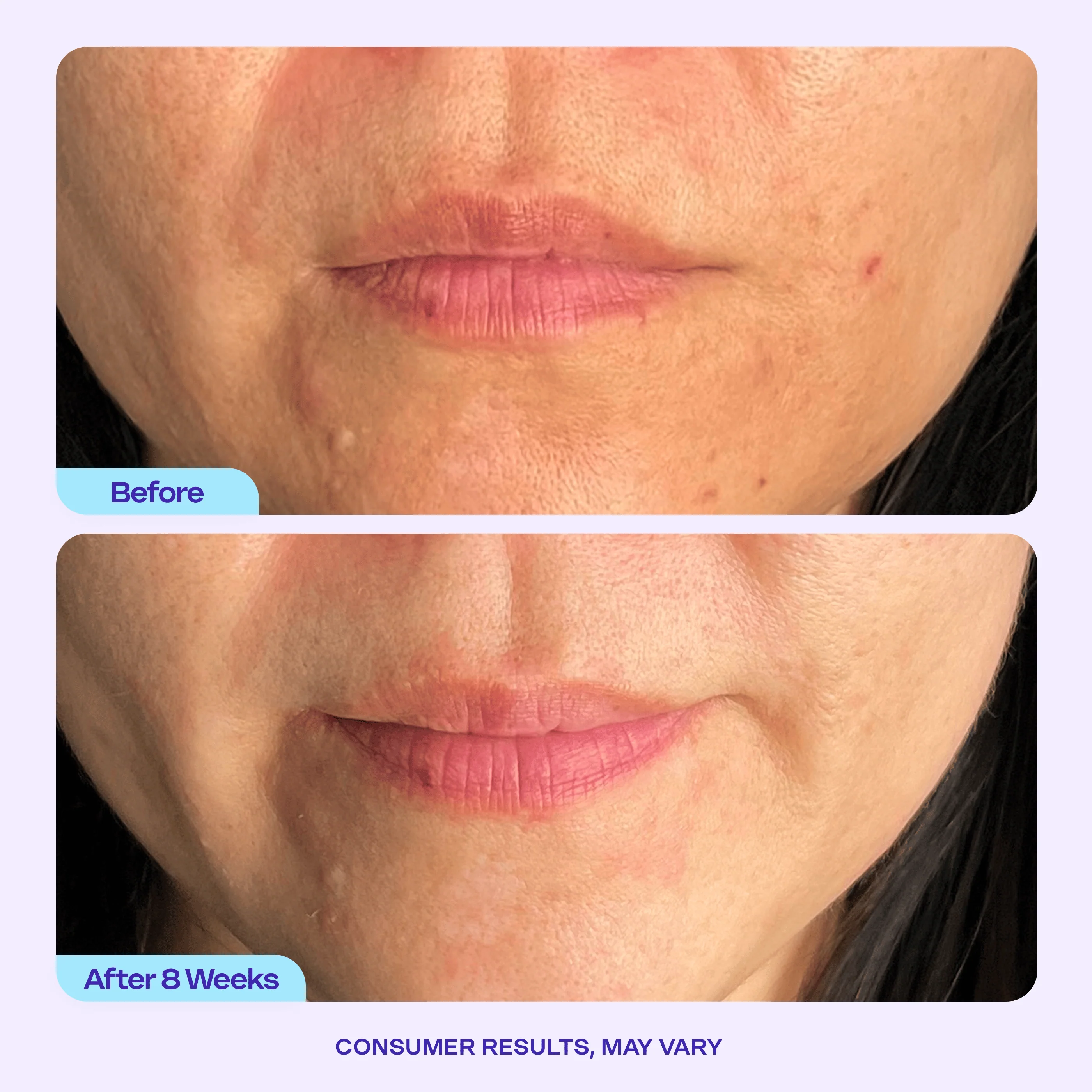 Try Before You Buy - Refine It! BHA Liquid Exfoliant - Image 5